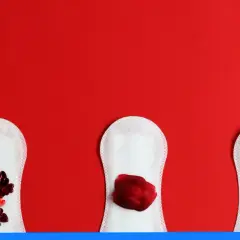 Obfite miesiączki: Kiedy są groźne i jak skutecznie leczyć?