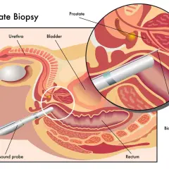 Badanie prostaty: Krok po kroku, bez strachu. Co Cię czeka?