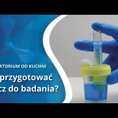 Prawidłowe pobranie moczu do badania: Klucz do trafnej diagnozy