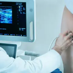 Lekarz wykonuje doppler żył kończyn dolnych, analizując obraz na monitorze.