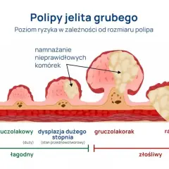 Rak jelita grubego: Czy badanie krwi wystarczy do diagnozy?