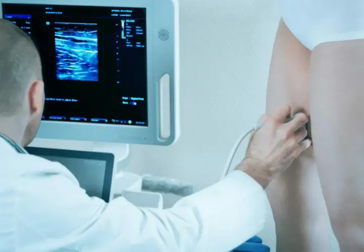 Lekarz wykonuje doppler żył kończyn dolnych, analizując obraz na monitorze.