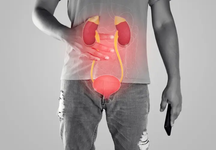 Anatomia układu moczowego z zaznaczonym bólem w okolicy nerek i pęcherza.