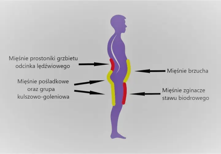 Schemat sylwetki z zaznaczonymi mięśniami. Widoczna pogłębiona lordoza lędźwiowa.