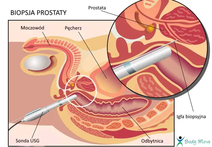 TRUS: Co to za badanie? Diagnostyka prostaty krok po kroku