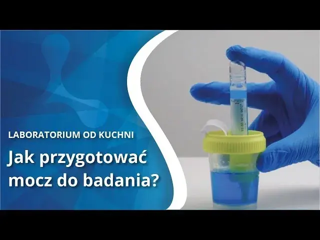 Prawidłowe pobranie moczu do badania: Klucz do trafnej diagnozy