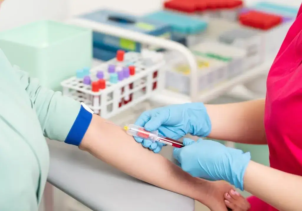 Pobieranie krwi do badania laboratoryjnego