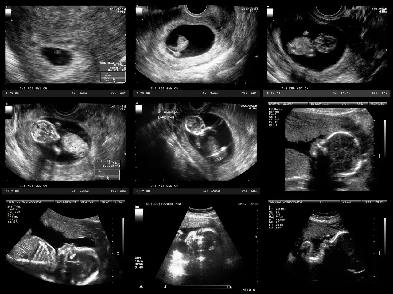 badania prenatalne po 40