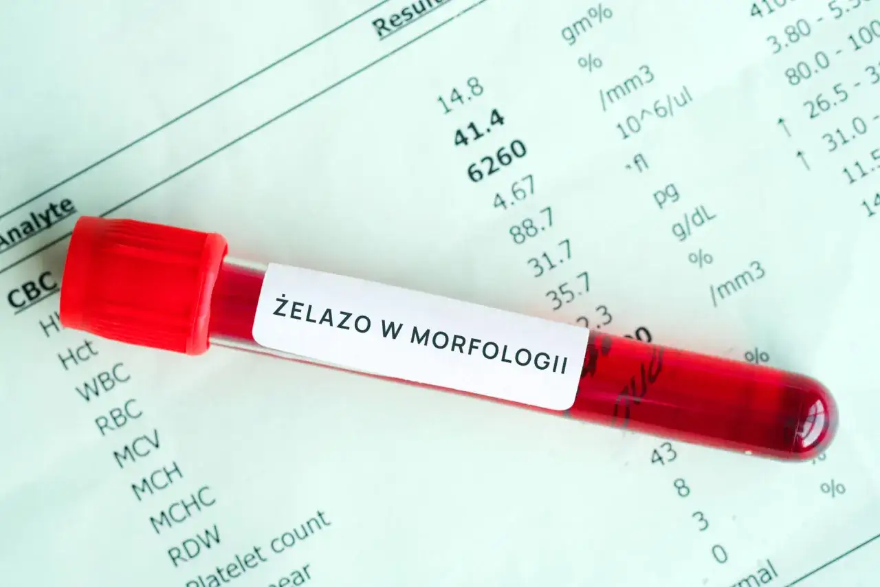 badanie krwi wyniki żelazo