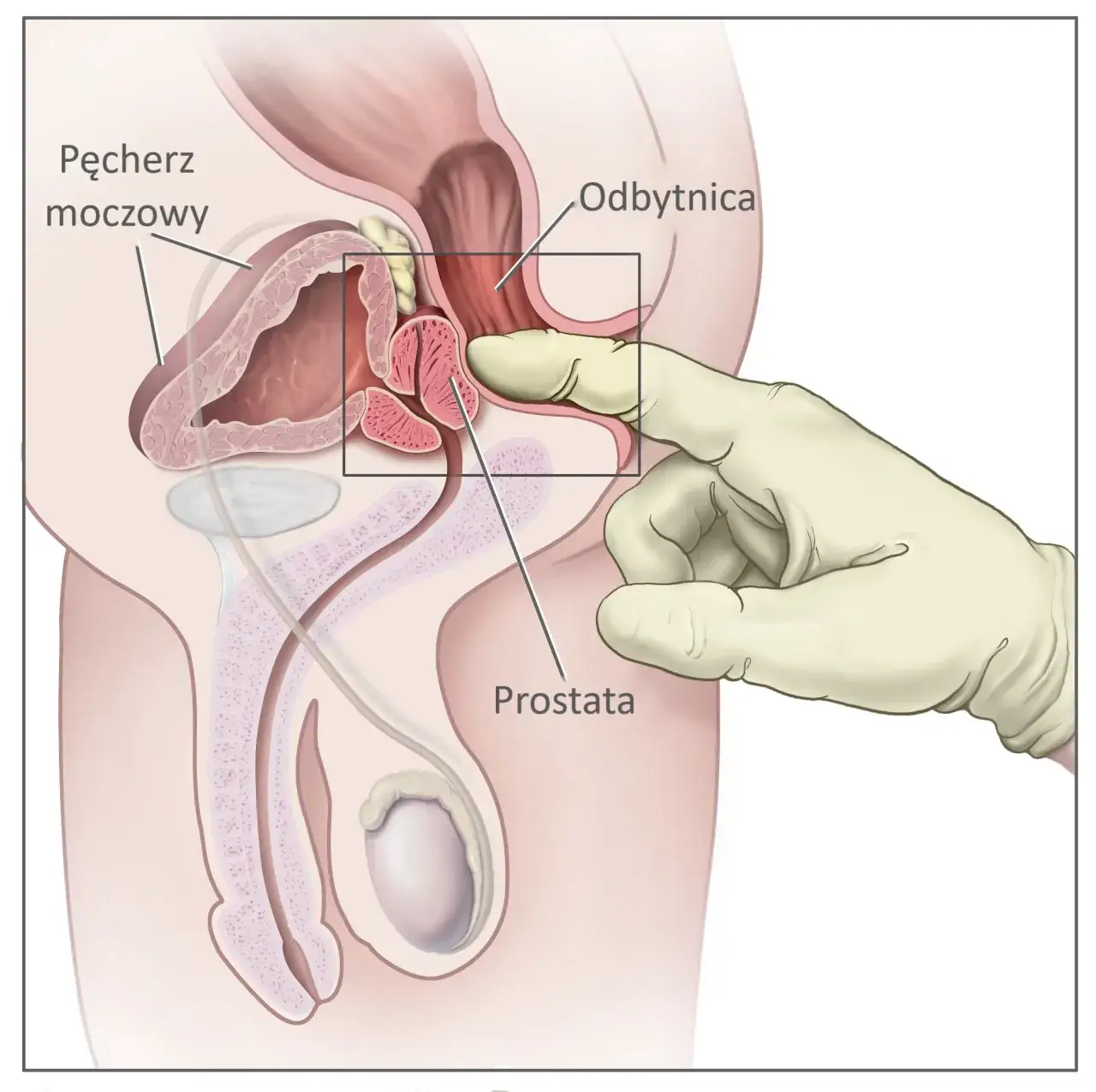 badanie per rectum schemat